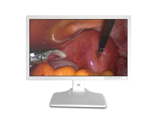 Ιατρική ενδοσκοπική επίδειξη 32inch εξαρτημάτων