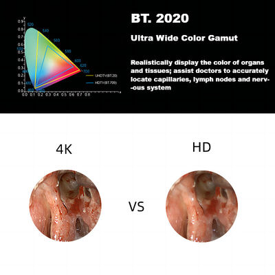 3840A νέο 4K υπερβολικό HD ιατρικό σύστημα καμερών ενδοσκοπίων Δεκεμβρίου για Laparoscopy